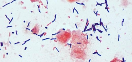 Un leve incremento ha tenido los casos de pacientes contagiados con la bacteria Clostridium Difficile en el Hospital Base de Los Ángeles
