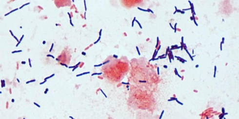 Un leve incremento ha tenido los casos de pacientes contagiados con la bacteria Clostridium Difficile en el Hospital Base de Los Ángeles